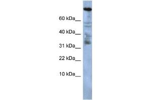 WB Suggested Anti-ZNF251 Antibody Titration:  0. (ZNF251 Antikörper  (Middle Region))