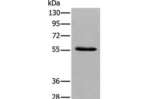 Western blot analysis of Human pancreas tissue using GPC4 Polyclonal Antibody at dilution of 1:500 (GPC4 Antikörper)