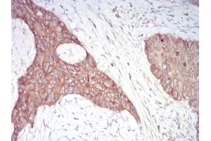 Immunohistochemistry (IHC) image for anti-Adducin 1 (Alpha) (ADD1) (AA 1-193) antibody (ABIN5542416)