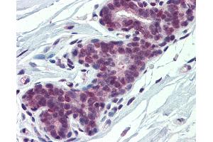 Anti-PCBP1 antibody IHC of human breast. (PCBP1 Antikörper  (AA 208-257))