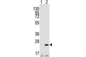 Western Blotting (WB) image for anti-BARX Homeobox 1 (BARX1) antibody (ABIN3003109) (BARX1 Antikörper)