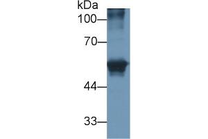 Detection of CEACAM1 in Human HepG2 cell lysate using Polyclonal Antibody to Carcinoembryonic Antigen Related Cell Adhesion Molecule 1 (CEACAM1) (CEACAM1 Antikörper)