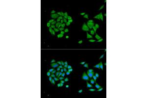 Immunofluorescence analysis of MCF-7 cells using DDX58 antibody. (DDX58 Antikörper)