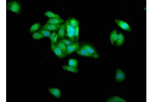 Immunofluorescence staining of HepG2 cells with ABIN7159237 at 1:266, counter-stained with DAPI. (PRAME Antikörper  (AA 1-509))