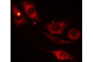 ABIN6275265 staining 293 cells by IF/ICC. (MYBPC1 Antikörper  (Internal Region))