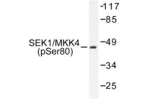 Image no. 1 for anti-Mitogen-Activated Protein Kinase Kinase 4 (MAP2K4) (pSer80) antibody (ABIN318113) (MAP2K4 Antikörper  (pSer80))