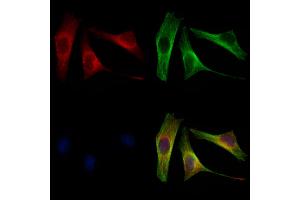 ABIN6264682 and ABIN6272949 staining 3 by IF/ICC.
