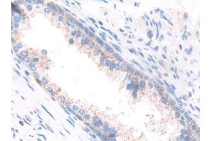 Detection of ECH1 in Human Prostate Tissue using Polyclonal Antibody to Enoyl Coenzyme A Hydratase 1, Peroxisomal (ECH1)