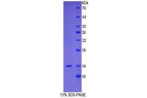 SDS-PAGE (SDS) image for Prostate Stem Cell Antigen (PSCA) (AA 22-123) protein (His tag) (ABIN1080579) (PSCA Protein (AA 22-123) (His tag))