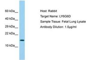 Image no. 1 for anti-Lymphocyte Antigen 6 Complex, Locus G6D (LY6G6D) (AA 14-63) antibody (ABIN6750057) (LY6G6D Antikörper  (AA 14-63))