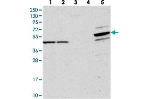 Western blot analysis of Lane 1: RT-4, Lane 2: U-251 MG, Lane 3: Human Plasma, Lane 4: Liver, Lane 5: Tonsil with PDE12 polyclonal antibody  at 1:250-1:500 dilution. (PDE12 Antikörper)