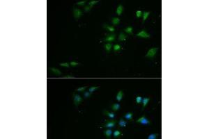 Immunofluorescence analysis of MCF7 cells using PPOX Polyclonal Antibody (PPOX Antikörper)