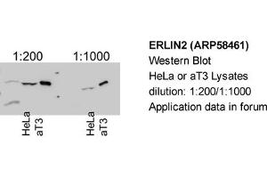 Western Blotting (WB) image for anti-ER Lipid Raft Associated 2 (ERLIN2) (Middle Region) antibody (ABIN406694) (ERLIN2 Antikörper  (Middle Region))