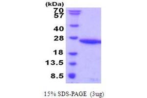 SDS-PAGE (SDS) image for Ubiquitin-Conjugating Enzyme E2G 1 (Ube2g1) (AA 1-170) protein (His tag) (ABIN5853980)