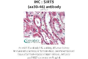 Image no. 1 for anti-Sirtuin 5 (SIRT5) (AA 30-46) antibody (ABIN1739285) (SIRT5 Antikörper  (AA 30-46))