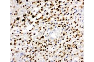 IHC-P: MPO antibody testing of human appendicitis tissue