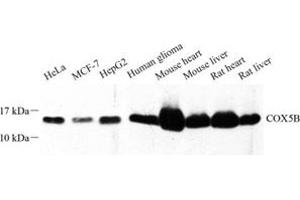 Western blot analysis of COX5B (ABIN7073665) at dilution of 1: 500 (COX5B Antikörper)