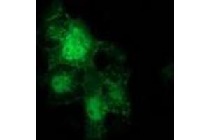 Anti-CTNNB1 mouse monoclonal antibody (ABIN2454135) immunofluorescent staining of COS7 cells transiently transfected by pCMV6-ENTRY CTNNB1 (RC208947). (CTNNB1 Antikörper)