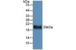 Detection of Recombinant IL19, Human using Monoclonal Antibody to Interleukin 19 (IL19) (IL-19 Antikörper  (AA 25-177))