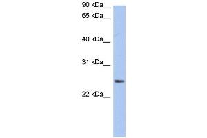 WB Suggested Anti-NRSN2 Antibody Titration:  0. (NRSN2 Antikörper  (Middle Region))