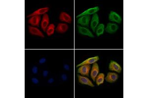 CCL14 Antibody staining Hela cells by IF/ICC. (CCL14 Antikörper  (Internal Region))