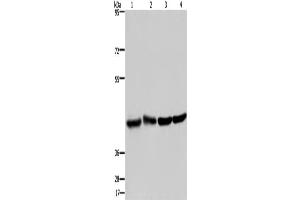 Western Blotting (WB) image for anti-Developmentally Regulated GTP Binding Protein 1 (DRG1) antibody (ABIN2423329) (DRG1 Antikörper)