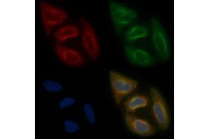 AWAT2 Mouse Monoclonal Antibody staining Hela cells by IF/ICC. (AWAT2 Antikörper  (Internal Region))