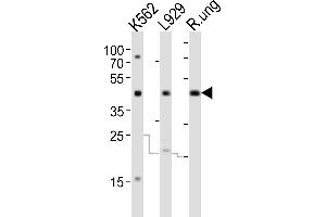 Western Blotting (WB) image for anti-Transforming Growth Factor, beta 1 (TGFB1) antibody (ABIN6242662)