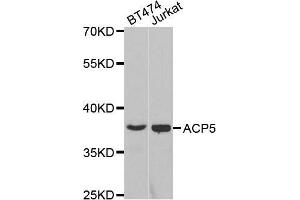 Western blot analysis of extracts of various cell lines, using ACP5 antibody. (ACP5 Antikörper  (AA 76-325))
