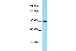 Western Blotting (WB) image for anti-IWS1 Homolog (IWS1) (N-Term) antibody (ABIN2790110) (IWS1 Antikörper  (N-Term))