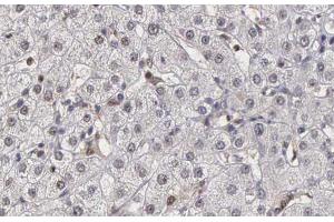 ABIN6266882 at 1/100 staining human liver tissue sections by IHC-P. (DNAJB1 Antikörper  (C-Term))