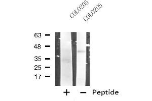 Western blot analysis of extracts from COLO205 cells, using RRM2B antibody. (RRM2B Antikörper  (N-Term))