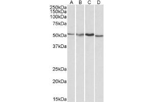 ABIN185314 (1µg/ml) staining of HepG2 (A), Jurkat (B), Mouse Brain (C) and Rat Brain (D) lysates (35µg protein in RIPA buffer). (AKT3 Antikörper  (AA 119-133))