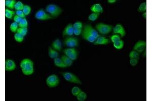Immunofluorescence staining of Hela cells with ABIN7139839 at 1:166, counter-stained with DAPI. (Foxo6 Antikörper  (AA 211-218))