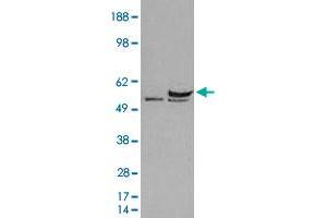 HEK293 overexpressing human DDX6 and probed with DDX6 polyclonal antibody  (mock transfection in first lane), tested by Origene. (DDX6 Antikörper)