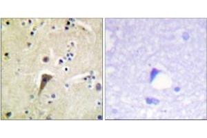 Immunohistochemistry analysis of paraffin-embedded human brain, using FAK (Phospho-Tyr397) Antibody. (FAK Antikörper  (pTyr397))