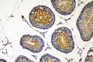 IHC analysis of SOX6 using anti-SOX6 antibody (ABIN7603012).