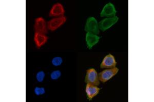 ABIN6258699 and ABIN6275026 staining Hela cells(30 min of UV treatment) by IF/ICC. (BEND4 Antikörper  (Internal Region))