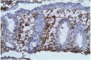 Labelling on frozen section (acetone fixed) of human colic mucosa with B-B20 diluted at 1:100 (background coloration by hematoxylin). (CD40 Antikörper)
