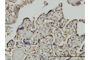 Immunostaining (ISt) image for anti-General Transcription Factor III (GTF2I) (AA 36-274) antibody (ABIN561180)