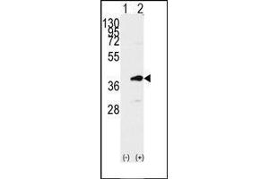 Western blot analysis of PBK (arrow) using rabbit polyclonal PBK Antibody (PBK Antikörper  (C-Term))