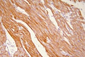 IHC analysis of Hsp20 using anti-Hsp20 antibody (ABIN5518920).