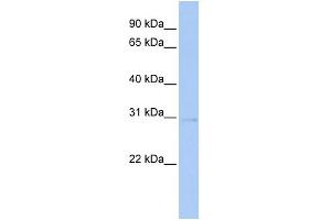 WB Suggested Anti-STK16 Antibody Titration:  0. (STK16 Antikörper  (Middle Region))