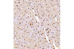 Immunohistochemistry of paraffin embedded mouse heart using RBAK (ABIN7075383) at dilution of 1:1000 (400x lens)