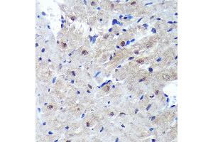 Immunohistochemistry of paraffin-embedded Mouse heart using PSME4 Rabbit pAb  at dilution of 1:100 (40x lens). (PSME4 Antikörper  (AA 1634-1843))
