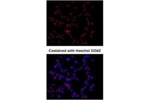 Immunofluorescence (IF) image for anti-Golgi Membrane Protein 1 (GOLM1) (C-Term) antibody (ABIN2856522)