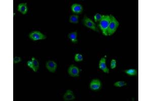 Immunofluorescence staining of HepG2 cells with ABIN7160065 at 1:166, counter-stained with DAPI. (MAP4K2 Antikörper  (AA 386-469))
