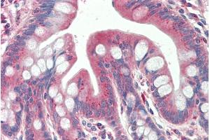 ABIN768661 (5µg/ml) staining of paraffin embedded Human Small Intestine. (TXNDC11 Antikörper  (AA 113-126))