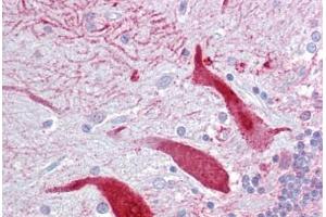 Anti-KCNQ2 antibody IHC staining of human brain, cerebellum.