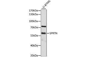 Western blot analysis of extracts of U-87MG cells, using SPRTN antibody (ABIN4905286) at 1:3000 dilution. (Spartan Antikörper)